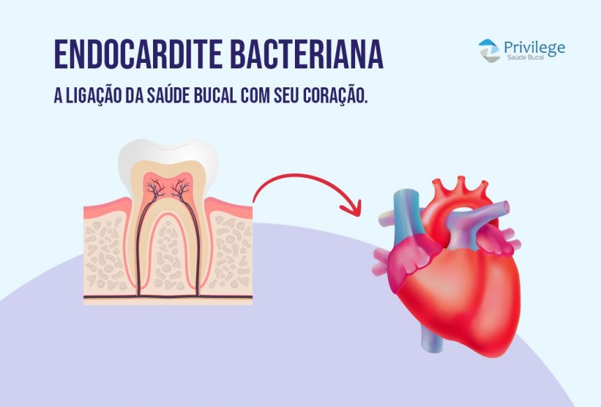 Higiene Bucal e a saúde do seu coração: Endocardite bacteriana